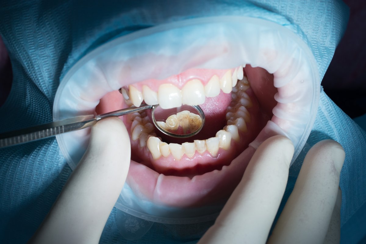 Как бесплатно лечить зубы в платной клинике