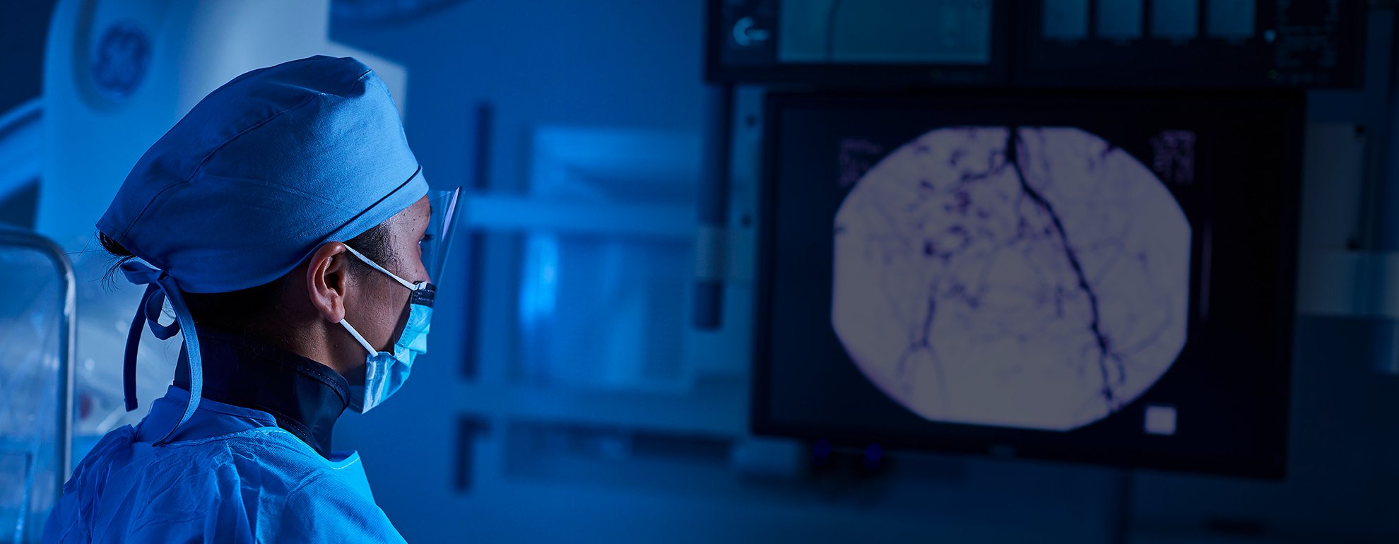 Best 10 Procedures of Interventional Radiology And Amazing Benefits