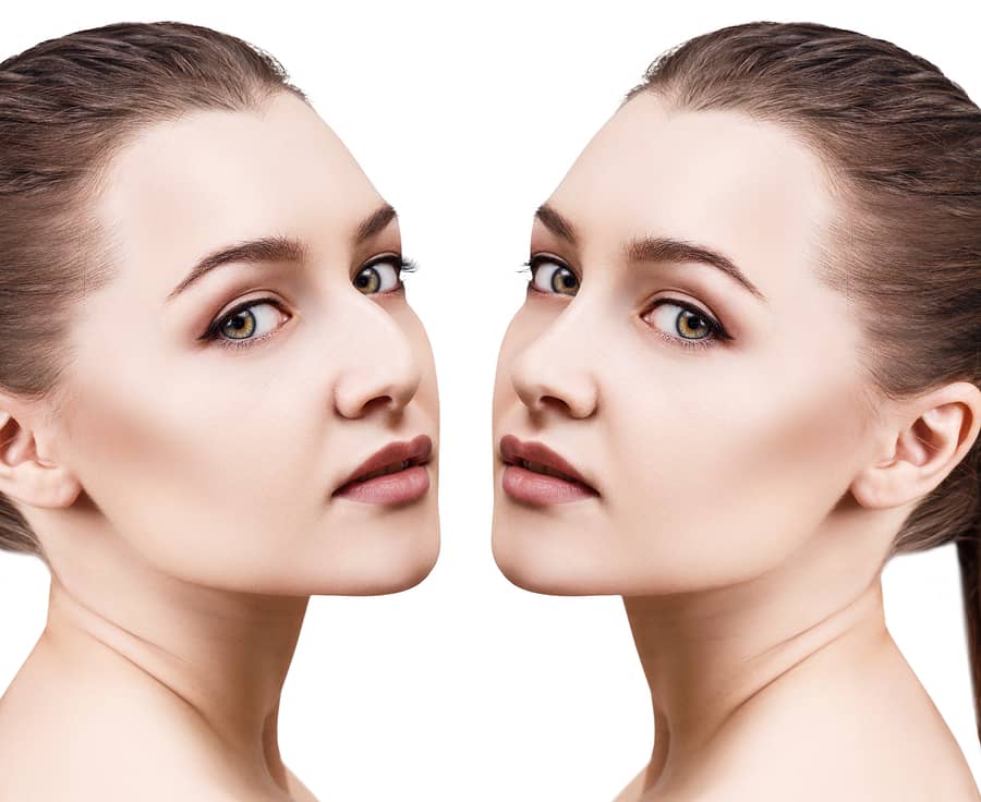 How Many Types of Nose Surgery Are There?