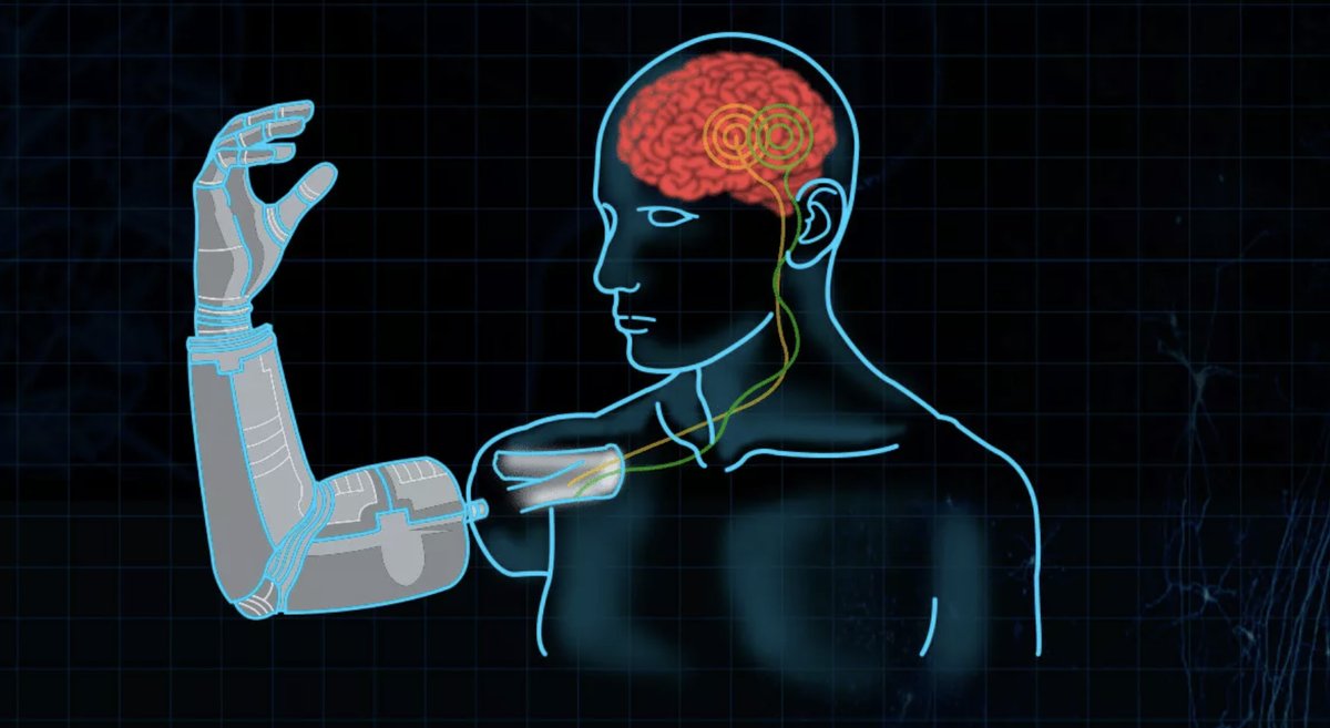 Neuralink Testing Robot Arm Controlled by Brain Chip