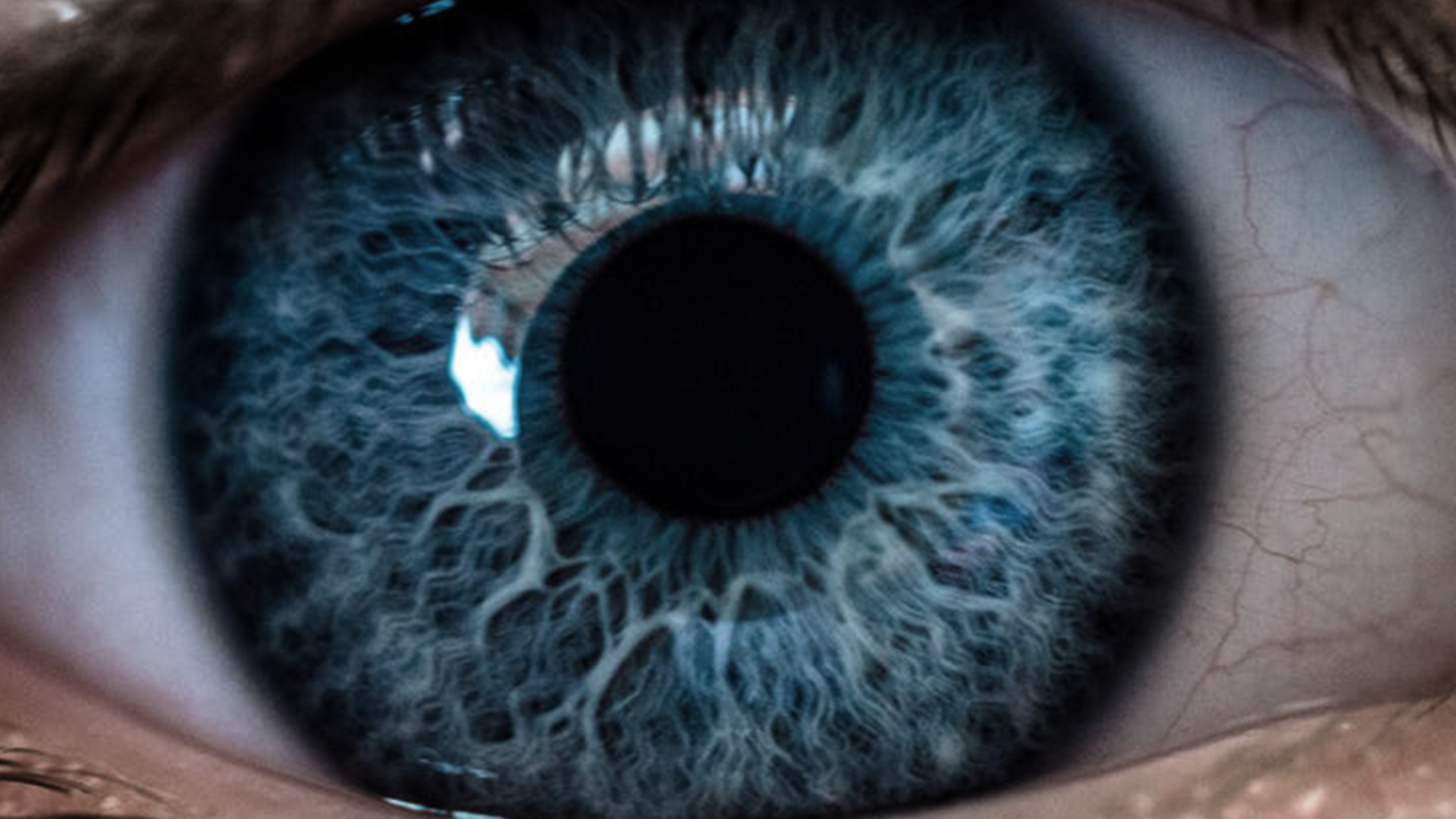 Neuralink Competitor Restores Vision in Blind Patients With Eye Implant