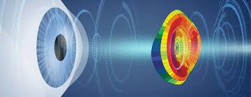 Your Quick Post-LASIK Surgery Guide: From Day  1 to Long-Term Care