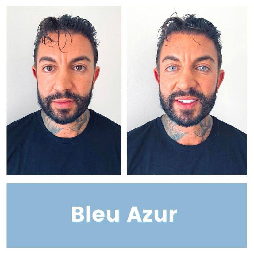 Changing Eye Color: Now a Reality, Not Just Sci-Fi Fantasy