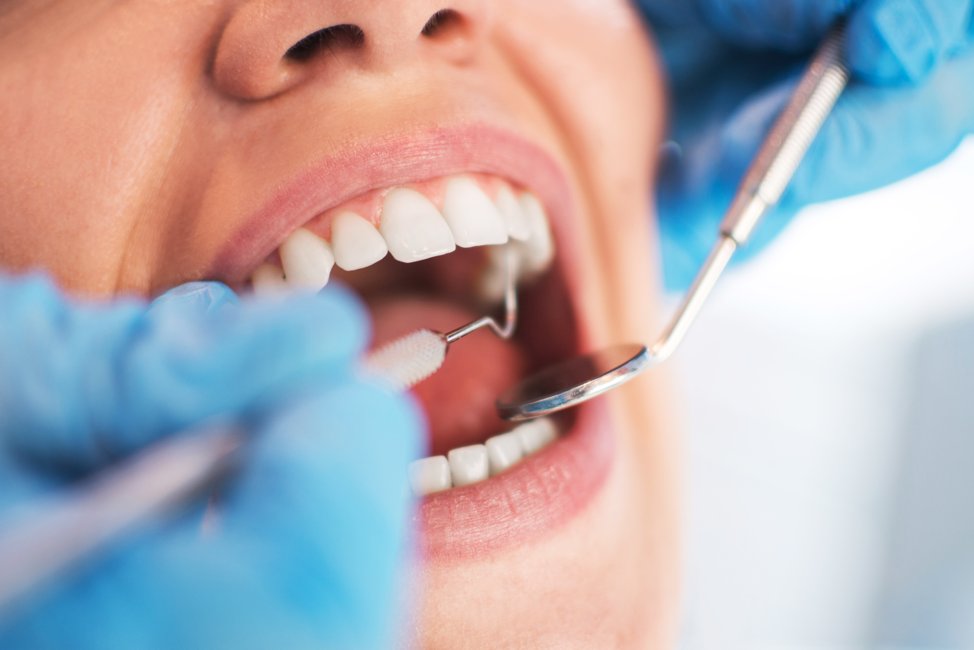 Importance of Dental Health, Dental Service