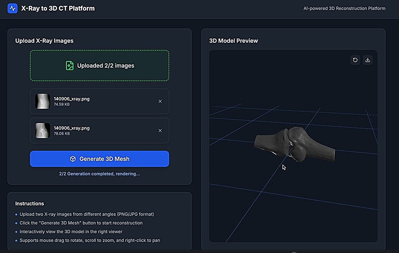 Hong Kong Researchers Unveil AI That Creates 3D Models of Organs and Bones from Just 2-4 X-Rays