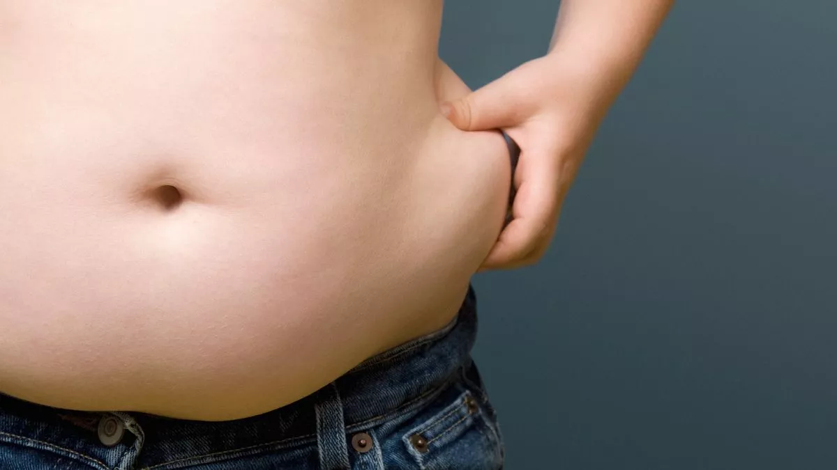 Fat cells have a 'memory' of obesity, study finds