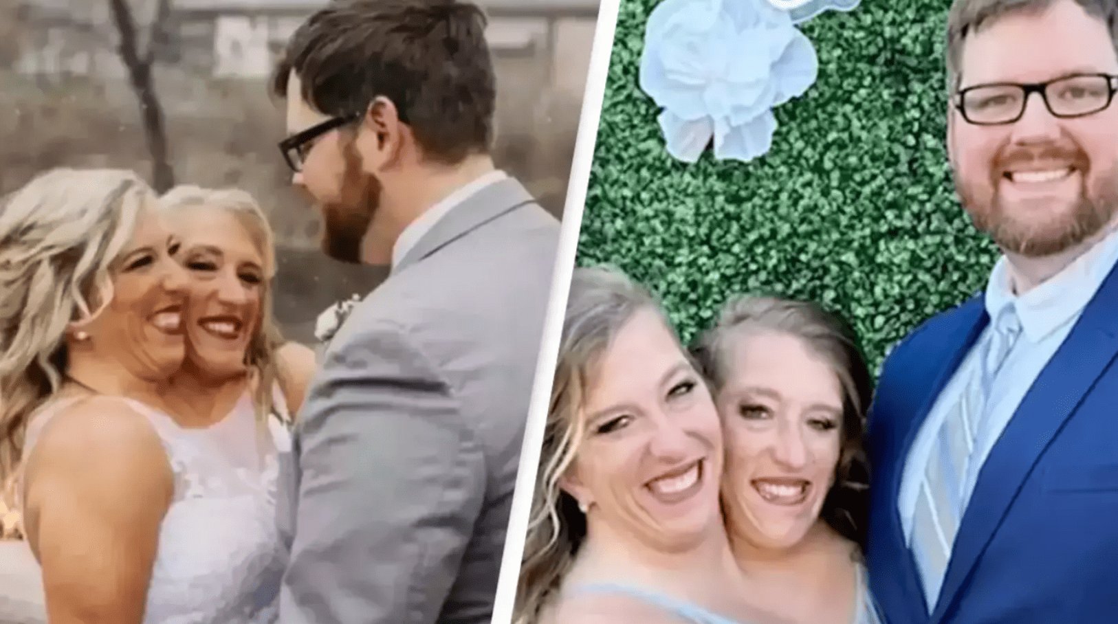 People are raising the same questions upon learning that conjoined twin Abby Hensel has gotten married.