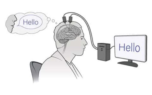 Internal Dialogue Can Now Be Overheard: Stanford’s Breakthrough in Decoding Inner Speech