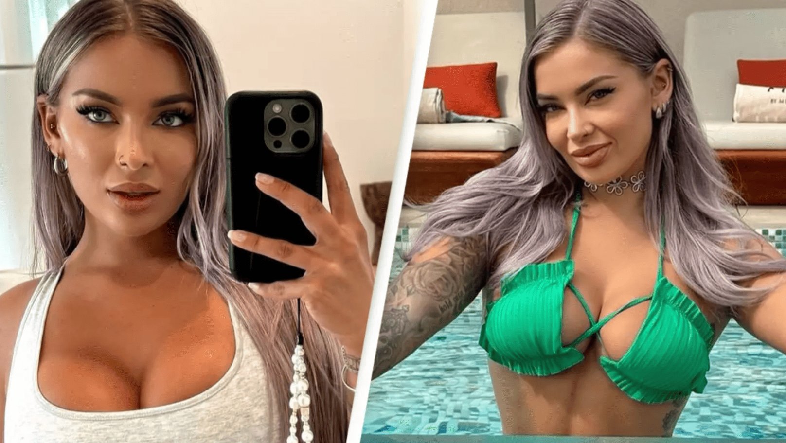 A woman recounts how a sexual accident resulted in her partner's penis being injured, leading to him losing part of his manhood