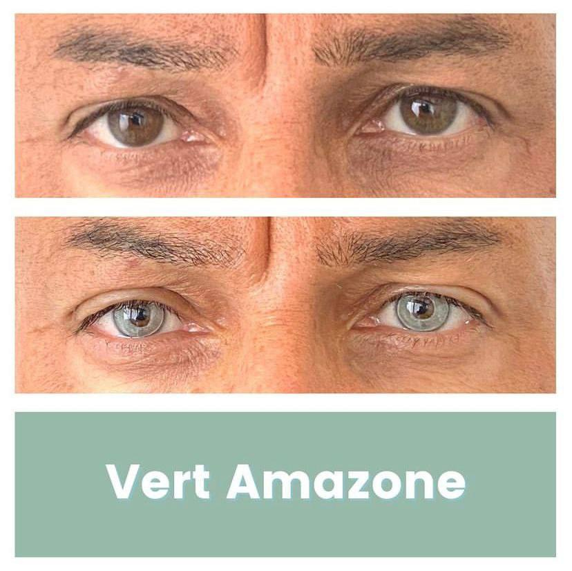 Changing Eye Color: Now a Reality, Not Just Sci-Fi Fantasy