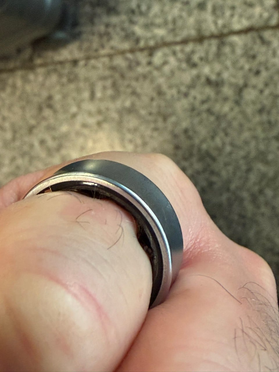 Warning for Wearables: Swollen Battery in Samsung Galaxy Ring Forces Emergency Removal
