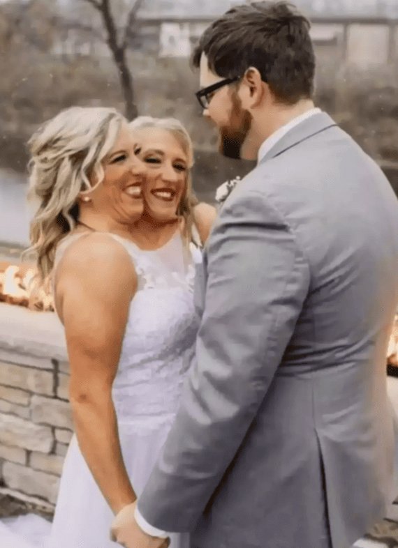 People are raising the same questions upon learning that conjoined twin Abby Hensel has gotten married.