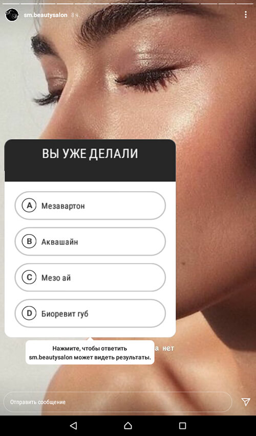 Опросы в сторис