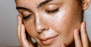 Top Ways to Get Healthy and Glowing Skin this Winter