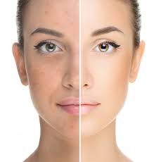 Exploring Different Types of Skin-Rejuvenating Peptides