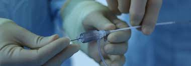 Best 10 Procedures of Interventional Radiology And Amazing Benefits