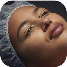 When Cosmetic Surgery Becomes More Than Just Aesthetic