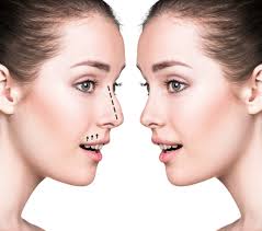 How Many Types of Nose Surgery Are There?