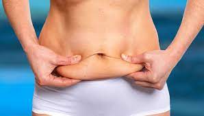 Are There Medical Reasons for Wanting a Tummy Tuck?