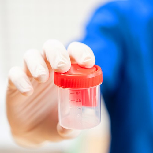 Сколько платят донору биоматериала