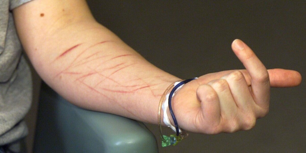 Фотография руки ребенка сидящего на руке взрослого человека.