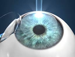  ophthalmologist in Dubai