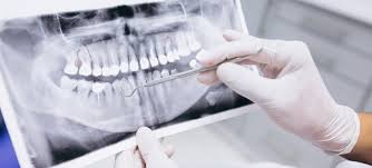 Why Families Prioritize Preventive Dental Health Today