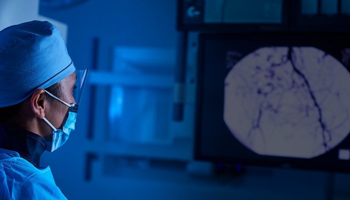 Best 10 Procedures of Interventional Radiology And Amazing Benefits