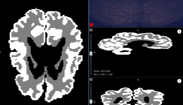 Russian Researchers Unveil First AI for Infant Brain MRI Analysis