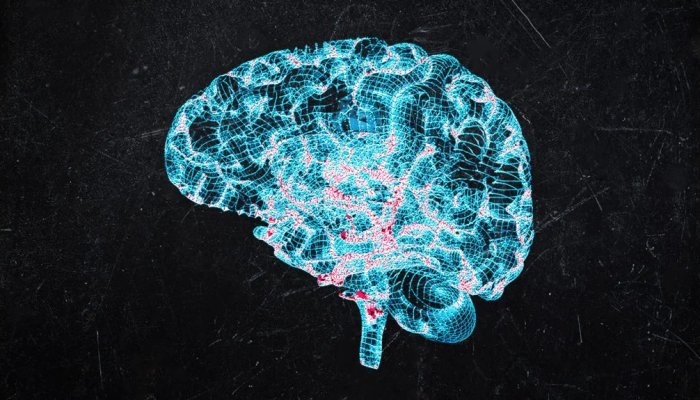 Different Stages of Parkinson’s Disease, Early Diagnosis, and Treatments