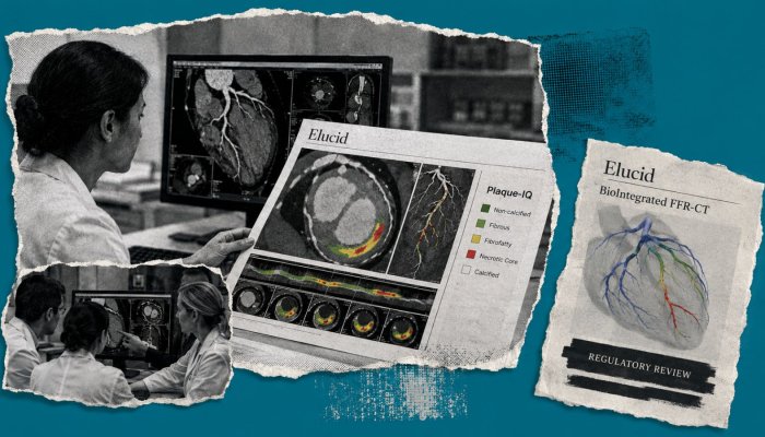 Elucid کو 5.5 کروڑ ڈالر—دل کی AI تشخیص کو اب بازار کا امتحان دینا ہے