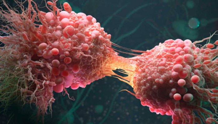 Scientist Injects Her Own Cancerous Tumor With Viruses She Grew in Lab