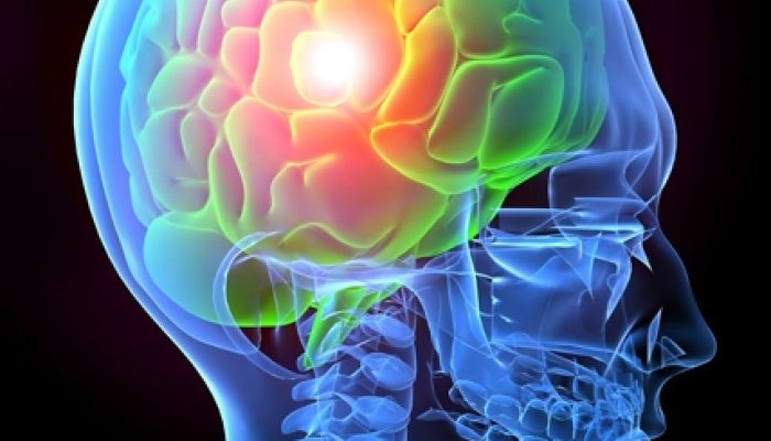 7 Key Facts About Traumatic Brain Injuries