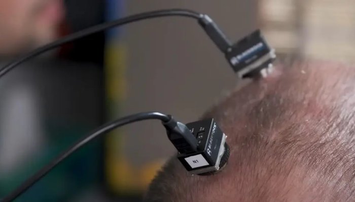 Groundbreaking Brain Chip Allows Man With ALS to "Speak" Again